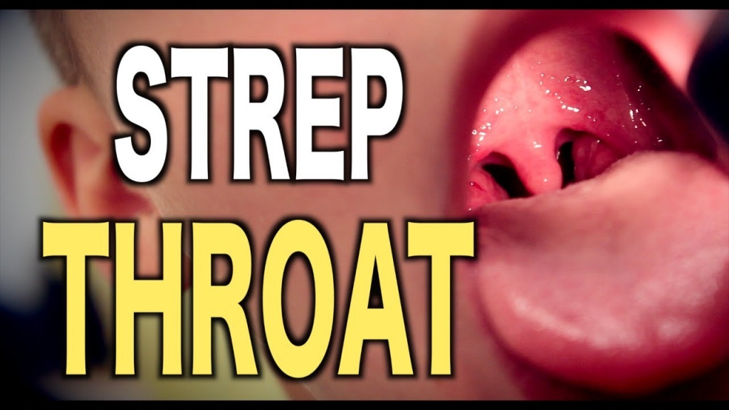 How Long Does A Strep Throat Last