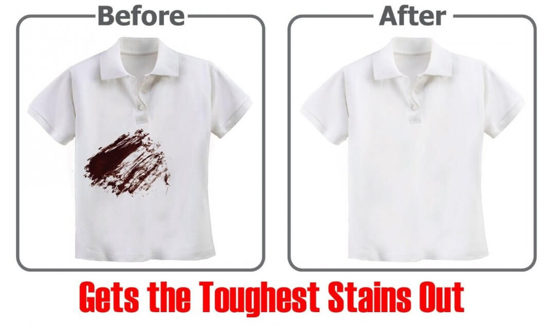 How To Get Blood Out Of Clothes Easy Tips And Tricks Scoopify