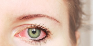 How Long Does Pink Eye Last on surface