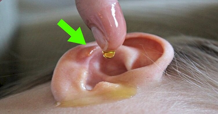 Vinegar & Alcohol To Get water out of ear