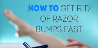How To Get Rid Of Razor Bump