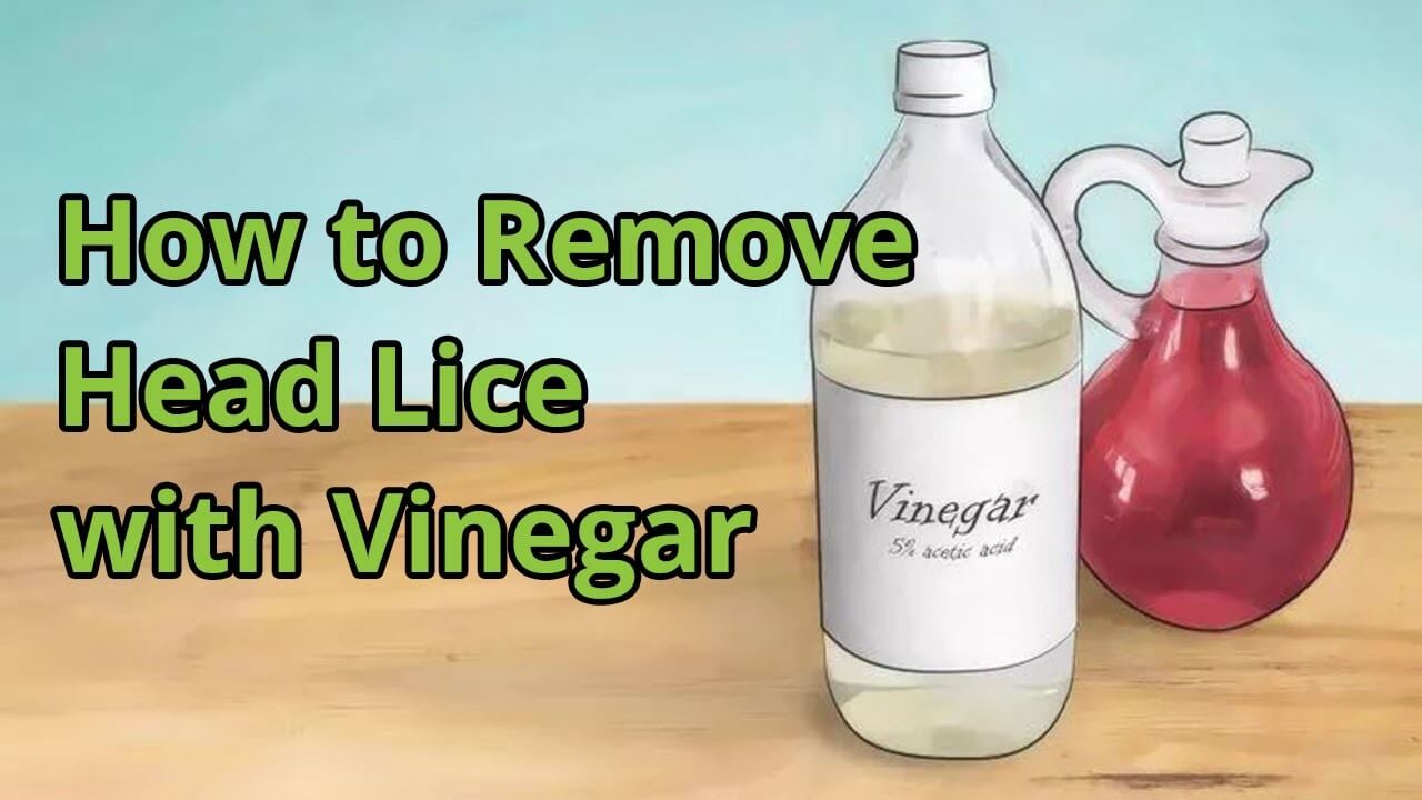 How to Get Rid of Lice Fast 8 Best Head Lice Treatment