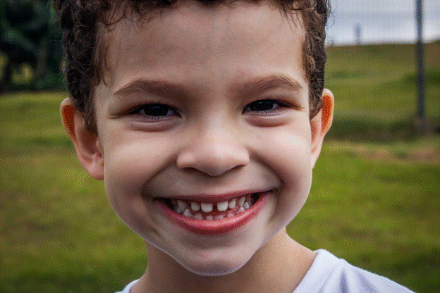 Teeth Grinding in Children