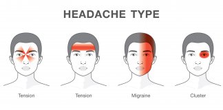 Different types of headache