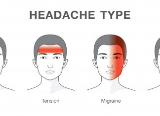 Different types of headache