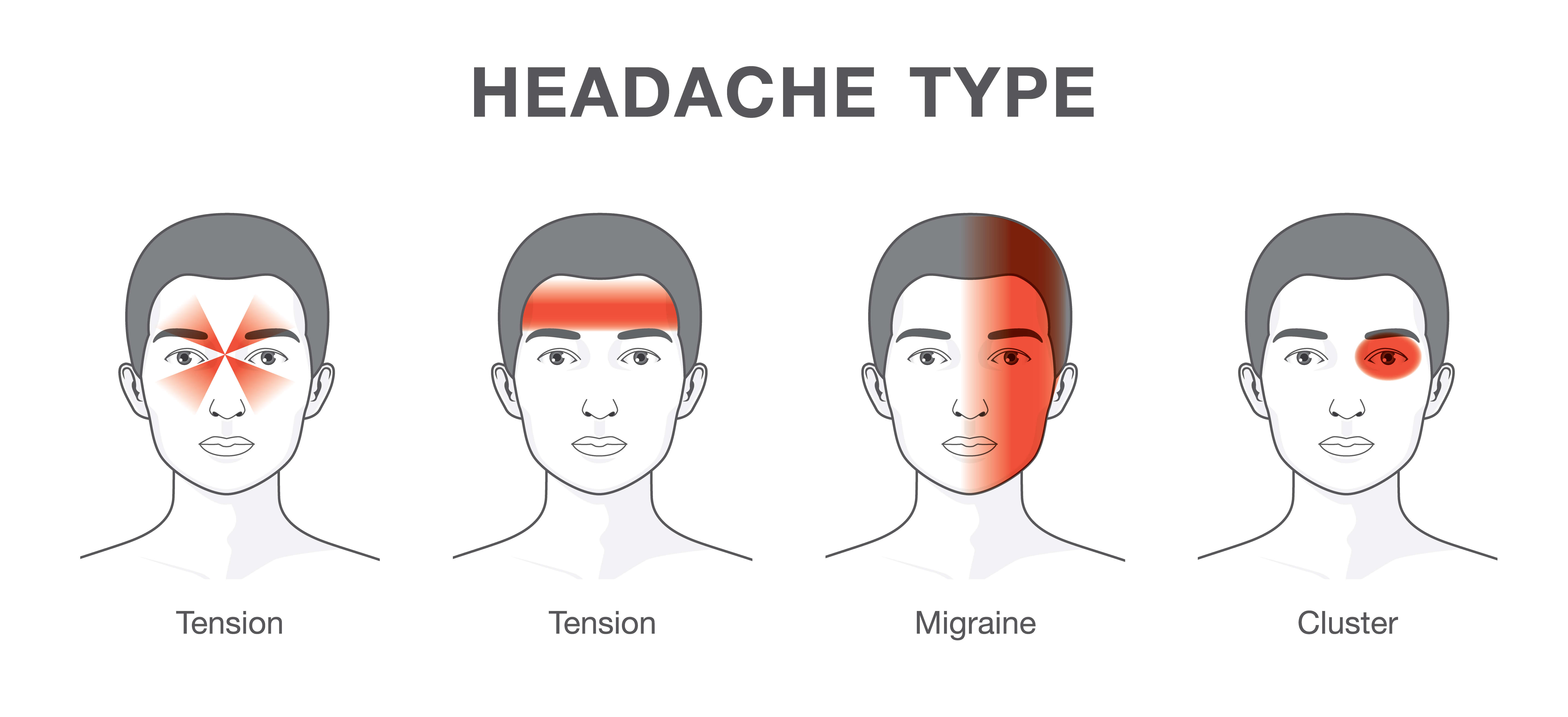 types of headache presentation