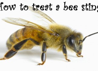 How to Treat a Bee Sting