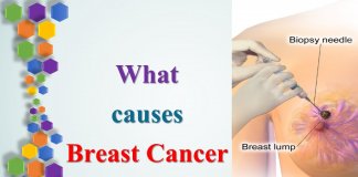 causes of breast cancer