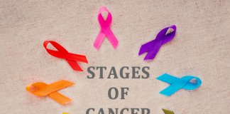 Stages- of- cancer