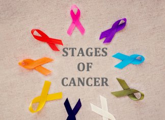 Stages- of- cancer