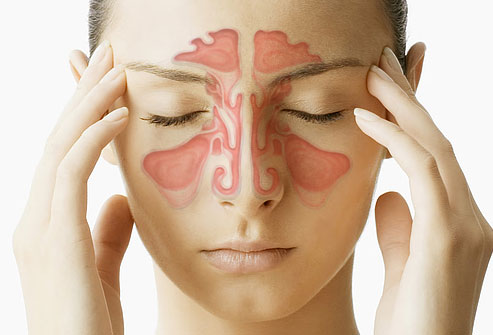 Sinus Infection