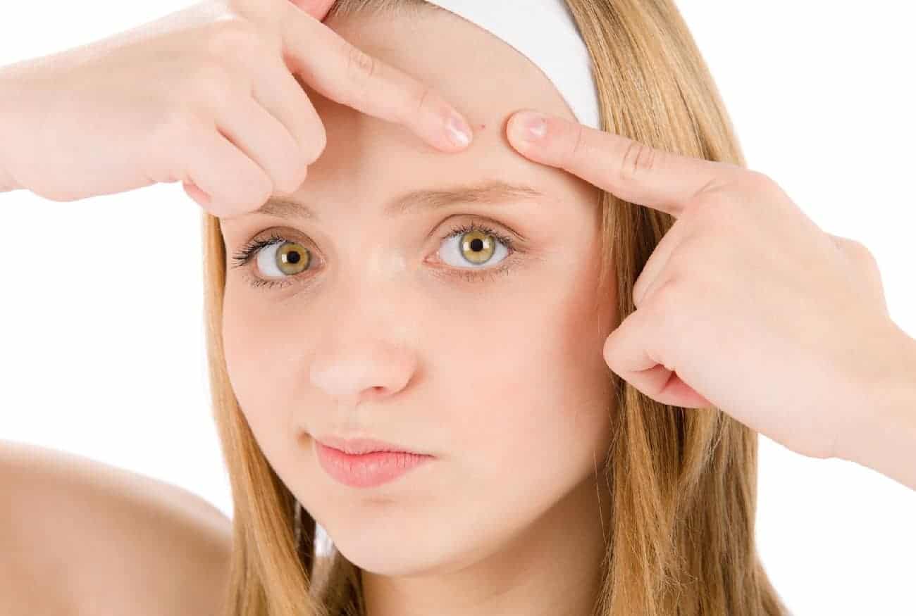 How To Get Rid Of Spots On Forehead