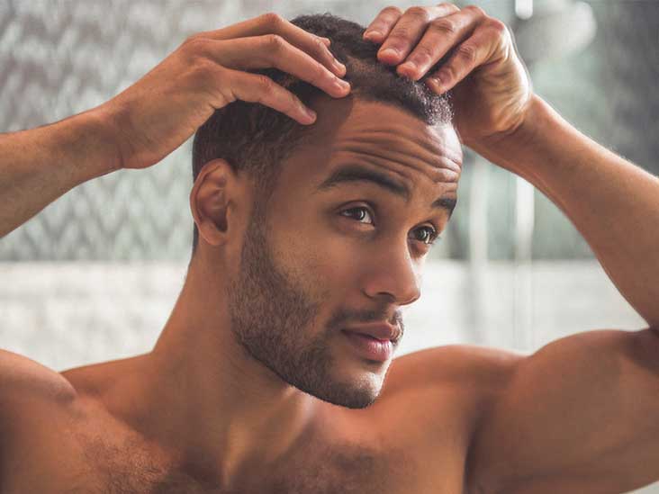 Hair Care Tips To Prevent Male Hair Loss - Scoopify