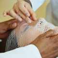 Gynecomastia Surgery in Bangalore