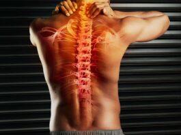 Exploring How to File for Settlement After Suffering a Herniated Disc