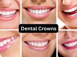 dental crowns