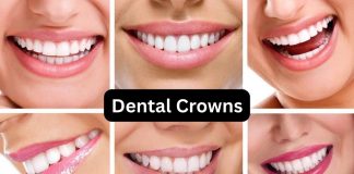 dental crowns