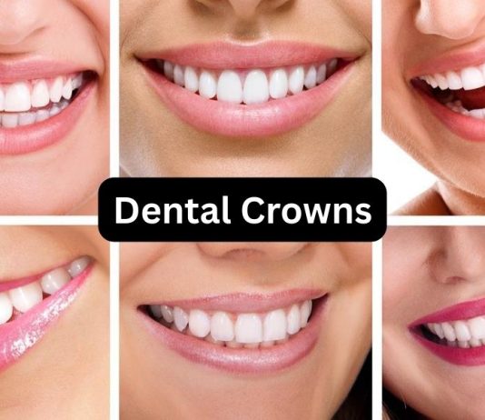 dental crowns