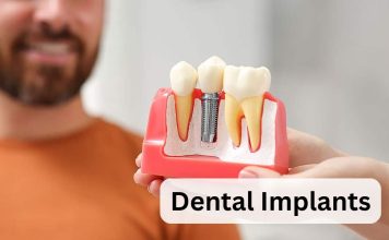 Dental Implants: A New Lease on Life dental implants