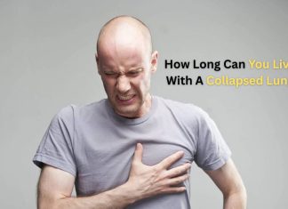 How Long Can You Live With A Collapsed Lung