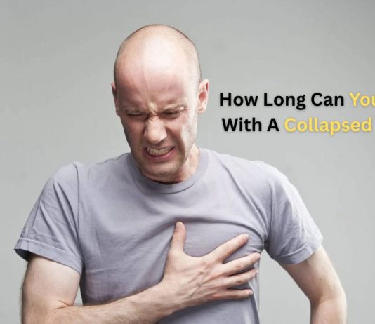 How Long Can You Live With A Collapsed Lung: Complete Guide (2026) How Long Can You Live With A Collapsed Lung